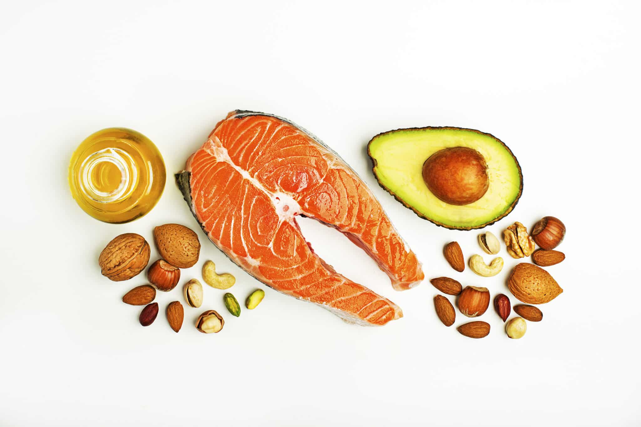 HEALTH AND FITNESS: Brainpower: What Is the Best Diet for Brain Health? 1