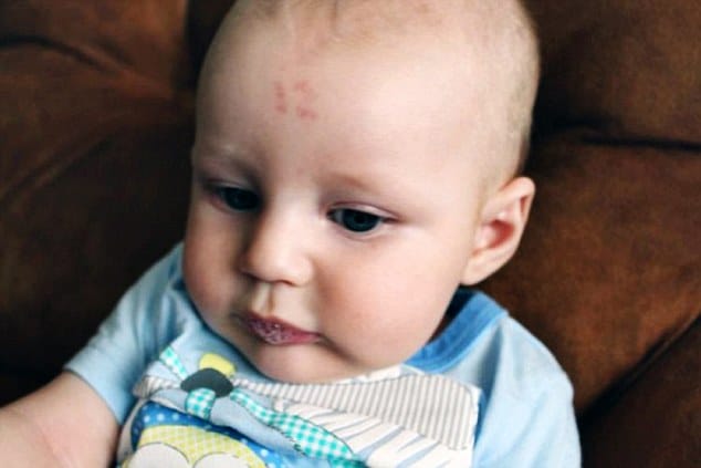 Dozen that birthmark look odd? 1